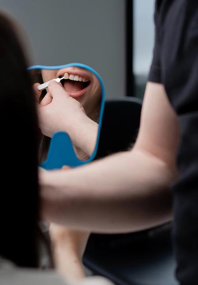 woman putting dental veneers on
